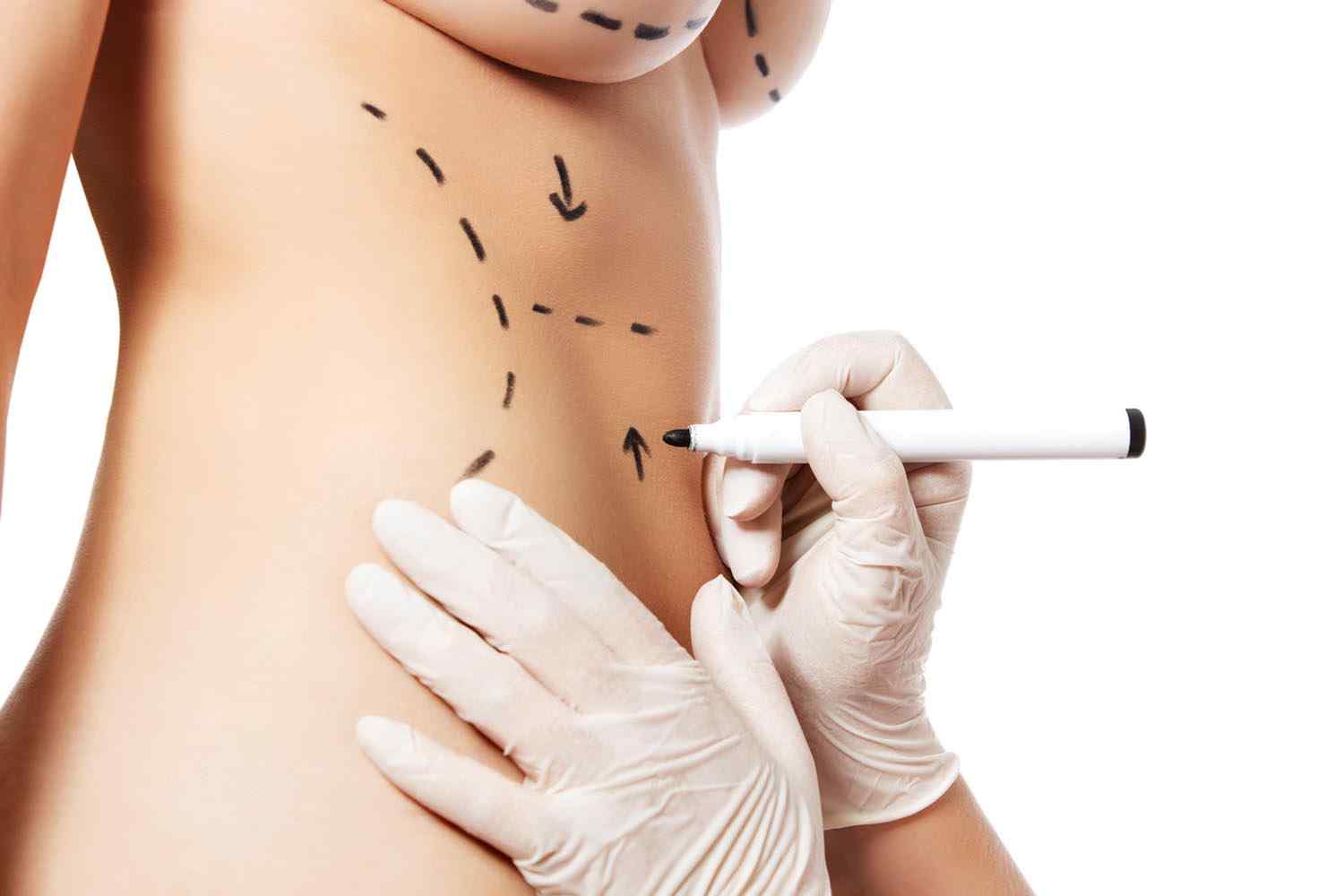 https://almaestetica.com.ec/wp-content/uploads/2017/08/cosmetic-surgery-blog-11.jpg